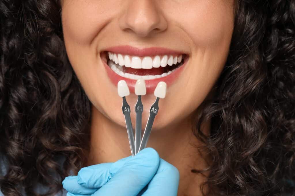 Durham Porcelain Veneers