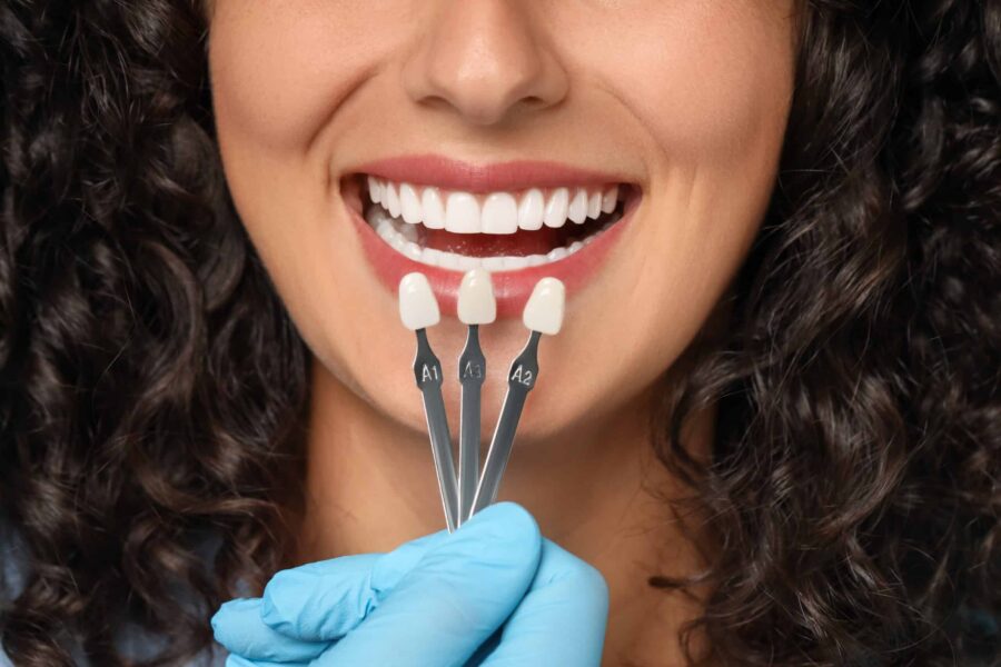Durham Porcelain Veneers