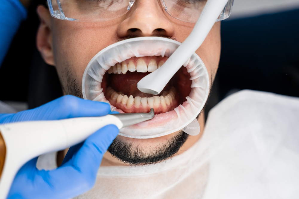 dental cleanings durham