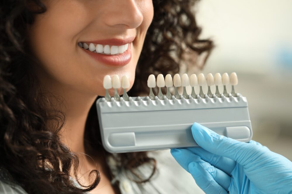dental veneers near durham